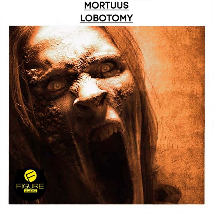 Mortuus – Lobotomy